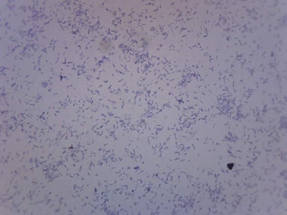 EISCO Clostridium Botulinum, Gram-Positive - Prepared Microscope Slide - 75 x 25mm - Biology & Microscopy