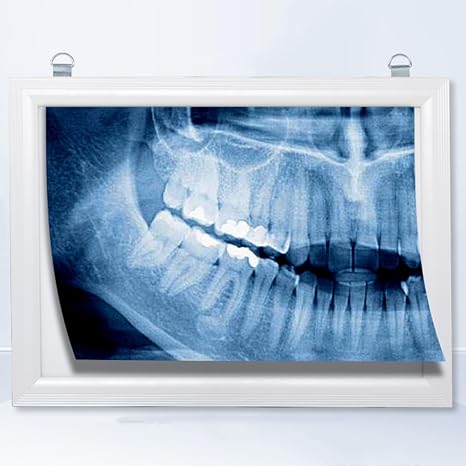 X-Ray Film Illuminator Light Box, 0.6in Thick X-ray Viewing Lamp, Dental Lab Equipment, with Hook, Easy to Install