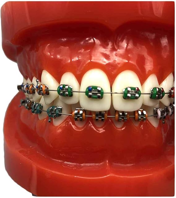 Orthodontic Teeth Model Dental Typodont with Mental Brackets Orthodontic Teeth with Ligature Ties Red