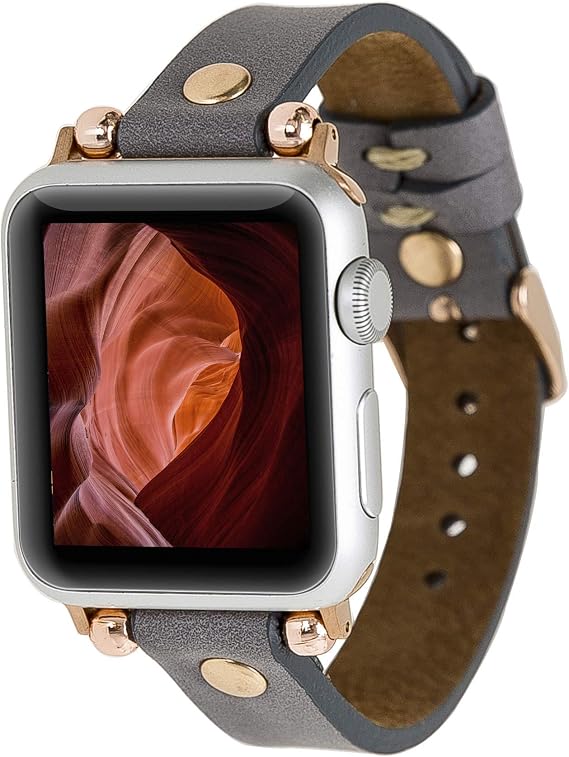 Bayelon Bouletta Fitbit Versa Deri Kordon Ferro RoseGold Troklu RST9 Gri