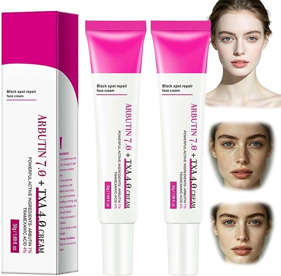 Arbutin 7% & Tranexamic Acid 4% Face Cream, Dark Spot Corrector for Women, Fades Freckles, Blemishes, Pigmentation & Evens Skin Tone