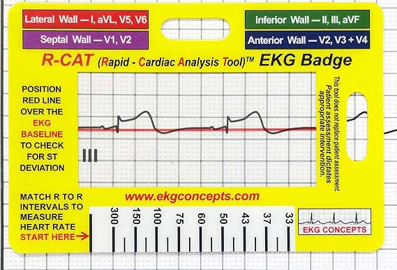 EKG Interpretation Tool/R-CAT Badge Card | Accurately Interpret ECG/EKG Rhythm Strips and 12 Lead EKG, Without Calipers, Badge Buddy